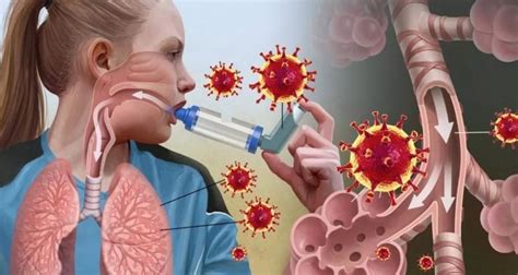 Аллергическая астма симптомы у взрослых