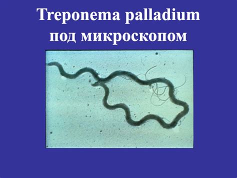 Антитела к treponema pallidum что это