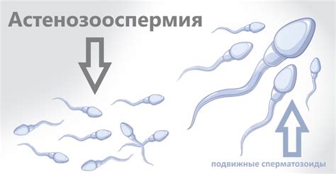 Астенозооспермия у мужчин