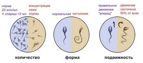 Астенозооспермия у мужчин