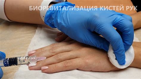 Биоревитализация рук