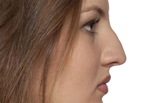 Греческий нос у женщин