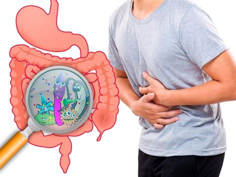 Дисбактериоз кишечника симптомы у взрослых мужчин