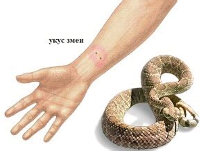 Как выглядит укус змеи медянки и гадюки фото