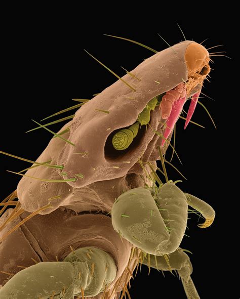 Как выглядят микробы