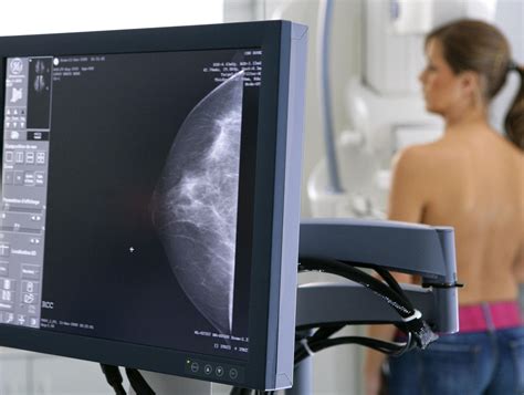 Как делается маммография молочных желез
