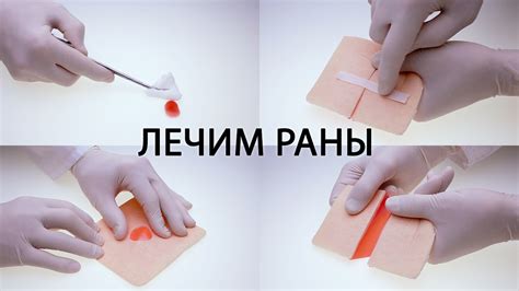 Как обработать рану при глубоком порезе