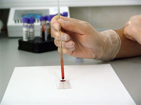 Как подготовиться к сдаче анализа крови