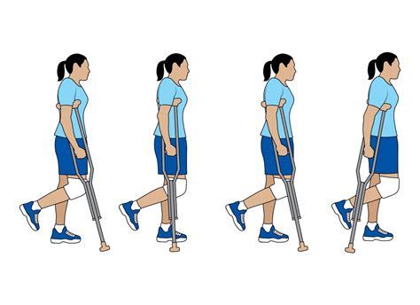Как ходить на костылях с одной ногой