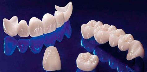 Керамика зубы