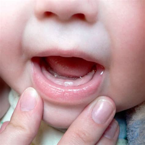 Когда лезут зубы у ребенка
