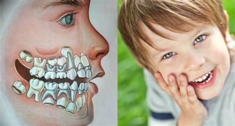 Коренные зубы у детей