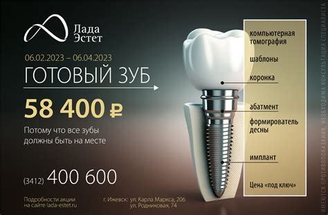 Лада эстет стоматология