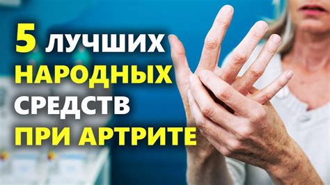 Лечение артрита суставов рук