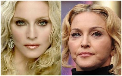 Мадонна до и после пластики