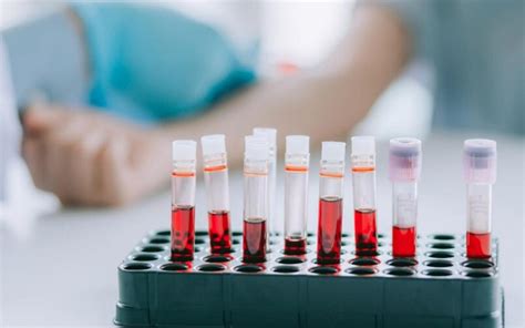 Можно ли по анализу крови определить онкологию