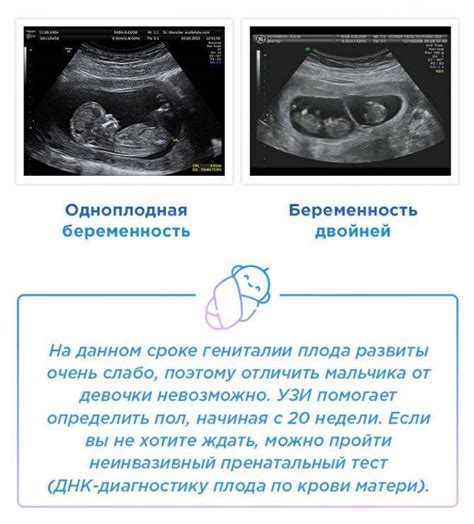 На каком сроке беременности можно узнать пол ребенка