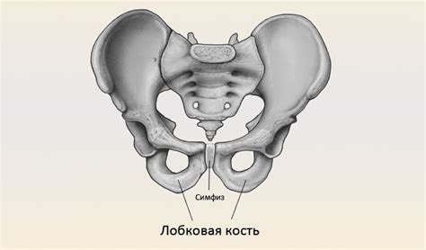 Перелом лонной кости таза