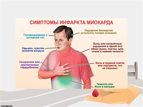 Признаки инфаркта миокарда у мужчин