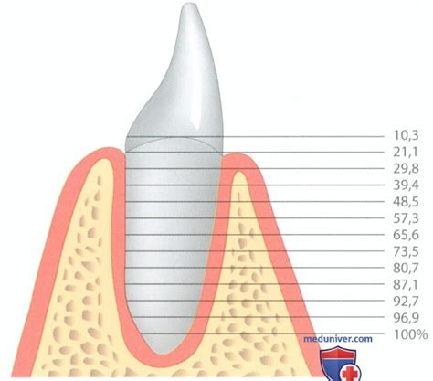 Резорбция корня зуба