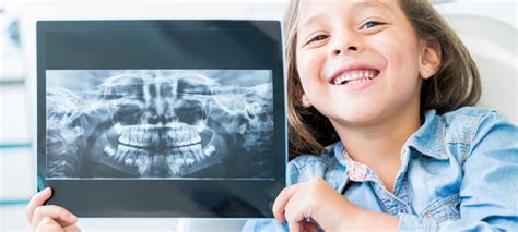 Рентген зубов ребенка