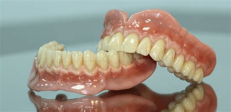 Съемные зубные протезы при полном отсутствии зубов цены