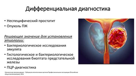 Туберкулез половых органов