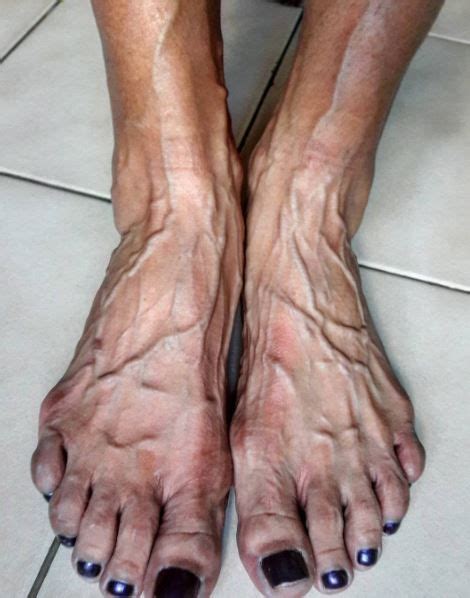 Foot feet